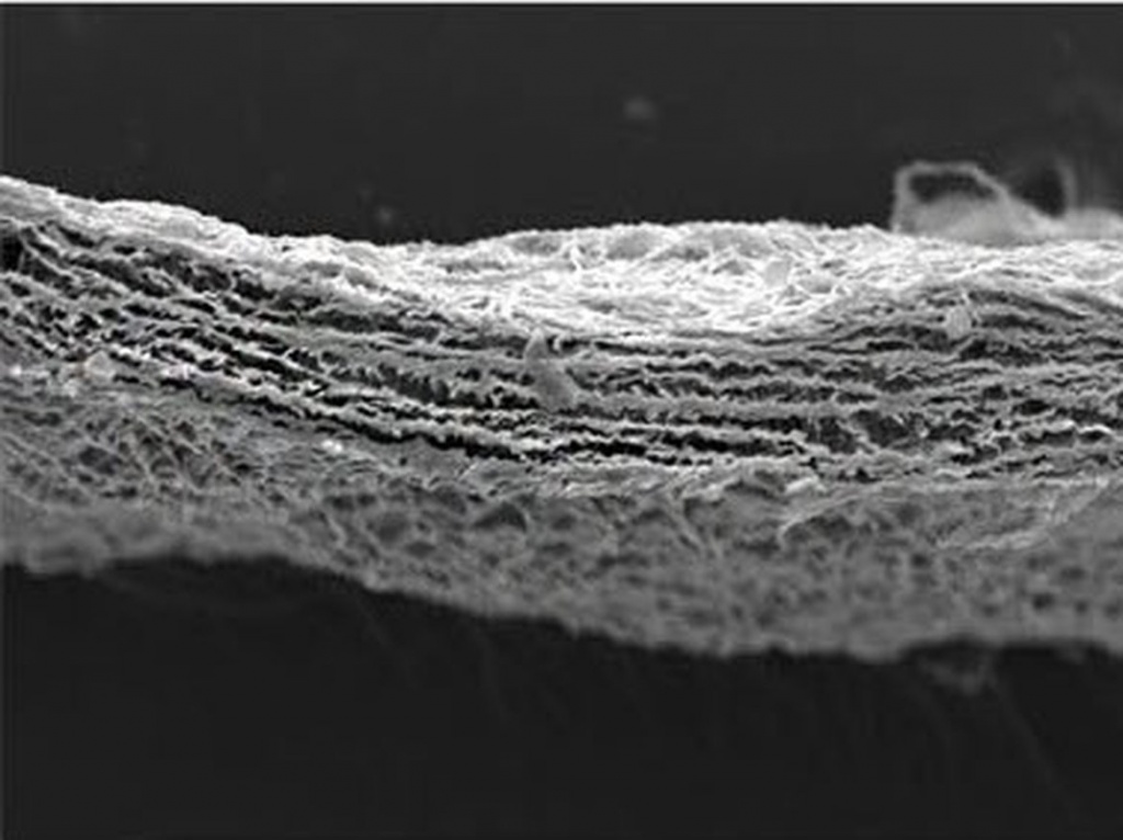 SMARTBRANE membrānas struktūra sekmē brūču dzīšanu un nodrošina labu barjeru starp kaulu un smaganu audiem